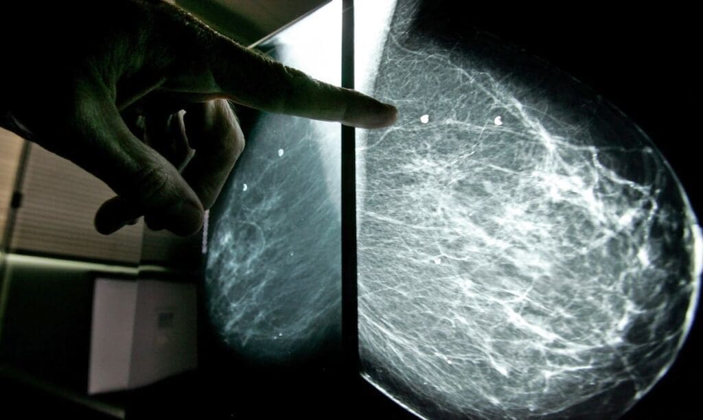 La Experiencia de una Tiktoker con el Sistema de Salud en Estados Unidos: Obstáculos y Críticas