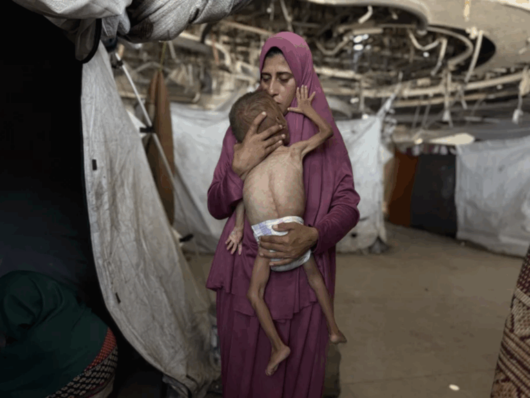 Gaza, entre el hambre y la guerra: Desolador informe de la ONU