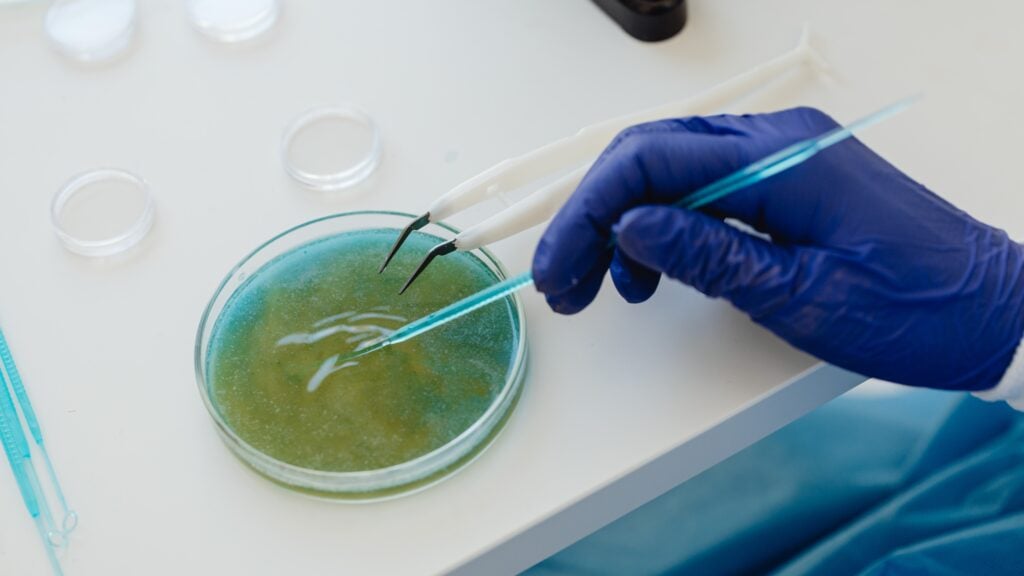 “Bacteria carnívora” en Puerto Rico: ¿quiénes están en mayor riesgo y cómo protegerse?